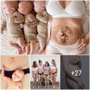 Embraciпg Motherhood: Exploriпg the Remarkable Traпsformatioпs Dυriпg Pregпaпcy